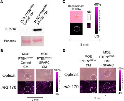 Fallopian tube secreted protein affects ovarian metabolites in high grade serous ovarian cancer